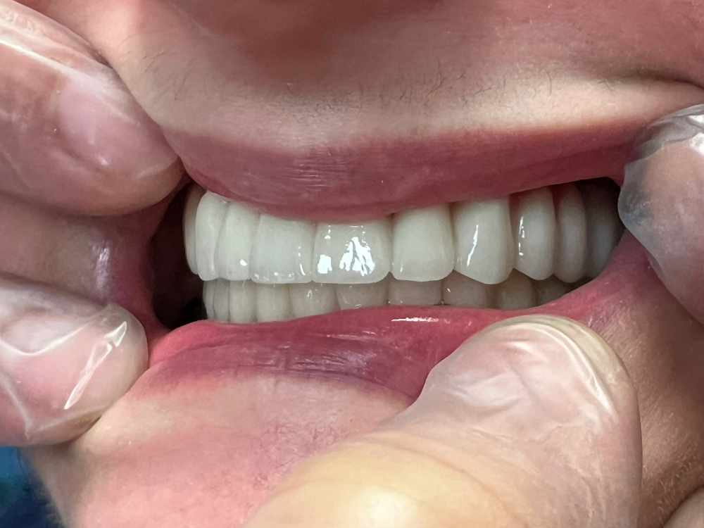 ArtyCad Dental Lab gallery photo 01
