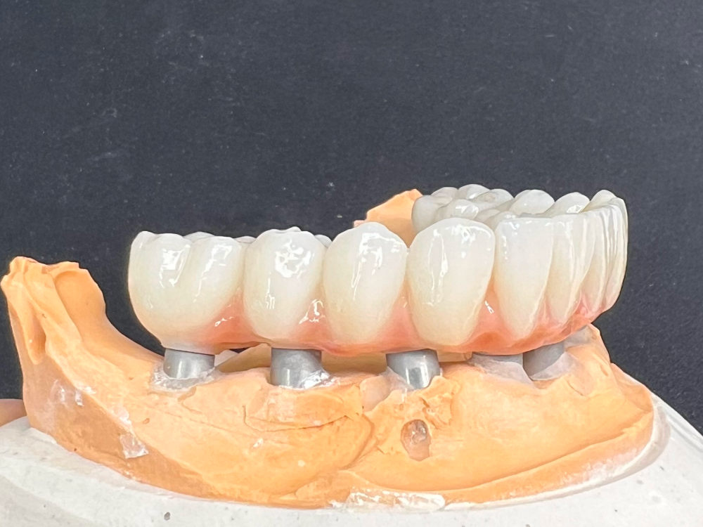 ArtyCad Dental Lab gallery photo 02