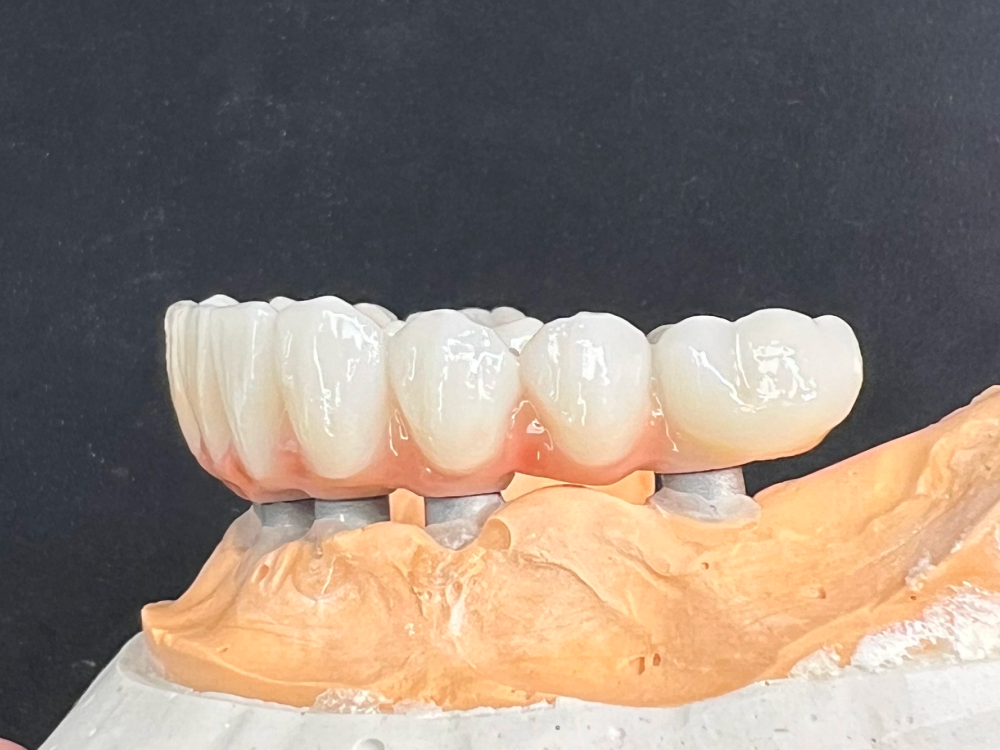 ArtyCad Dental Lab gallery photo 03