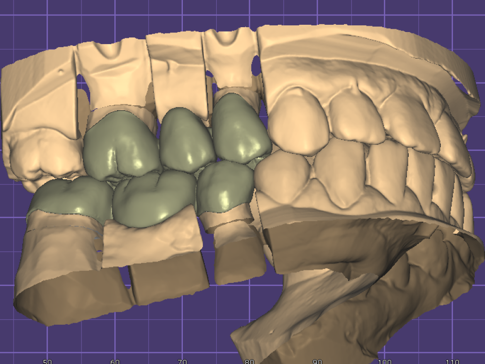 ArtyCad Dental Lab gallery photo 04