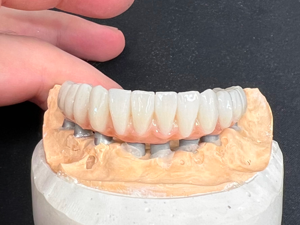ArtyCad Dental Lab gallery photo 05