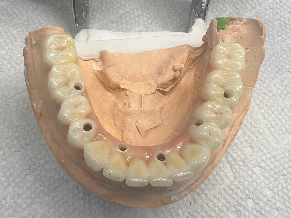 ArtyCad Dental Lab gallery photo 06