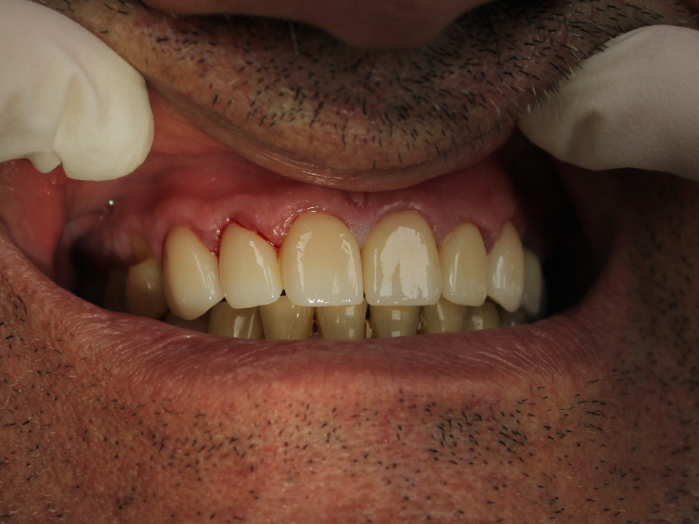 ArtyCad Dental Lab gallery photo 07