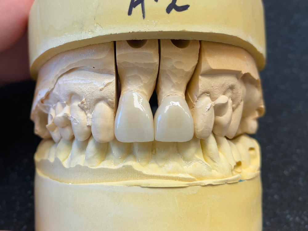 ArtyCad Dental Lab gallery photo 08