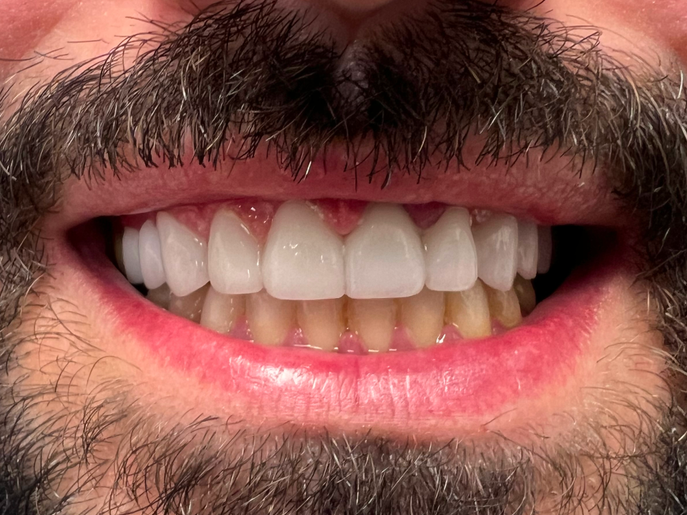 ArtyCad Dental Lab gallery photo 09