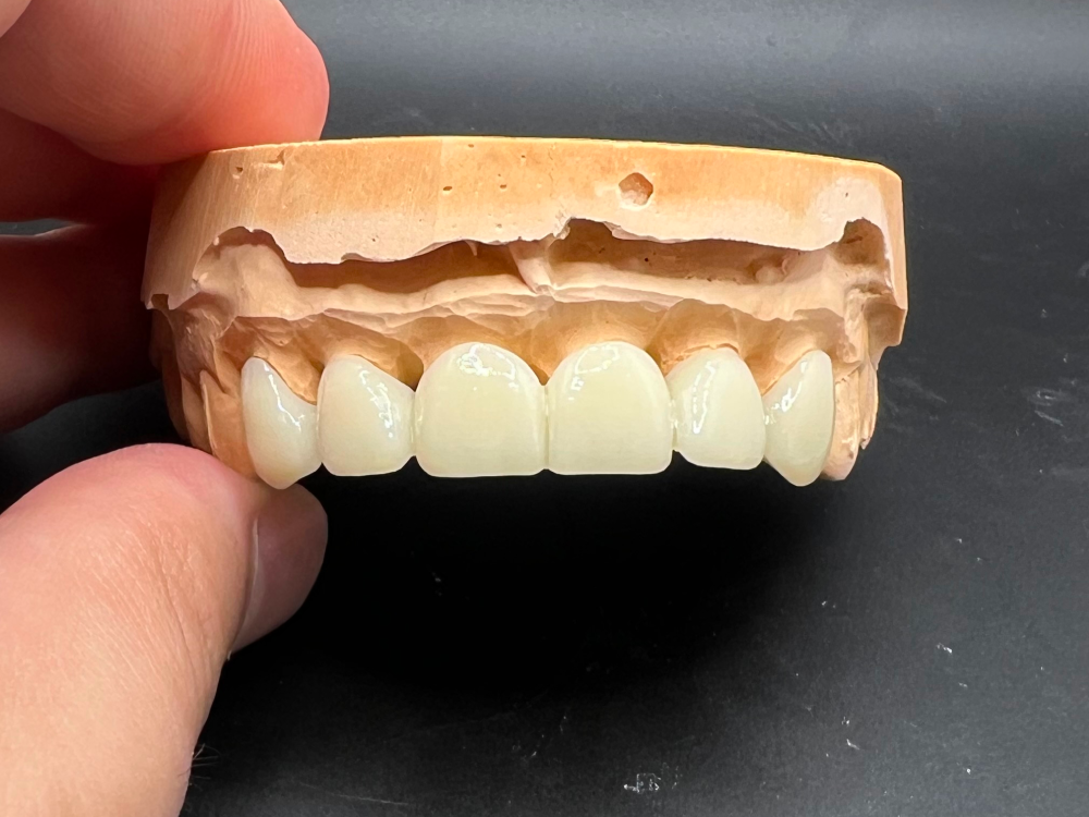 ArtyCad Dental Lab gallery photo 10