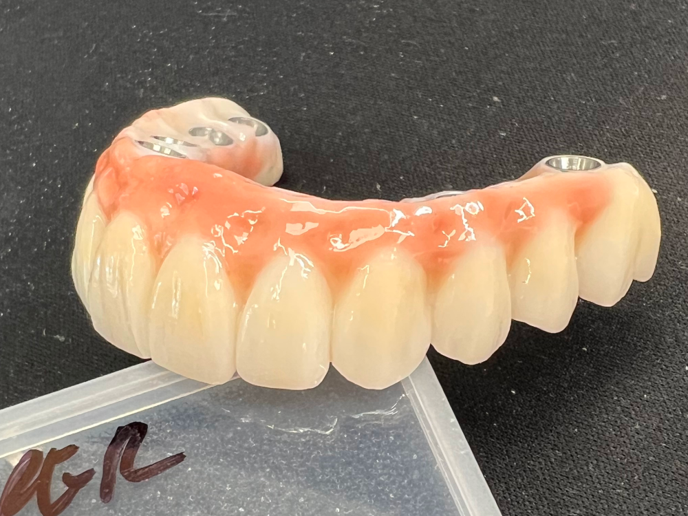 ArtyCad Dental Lab gallery photo 11