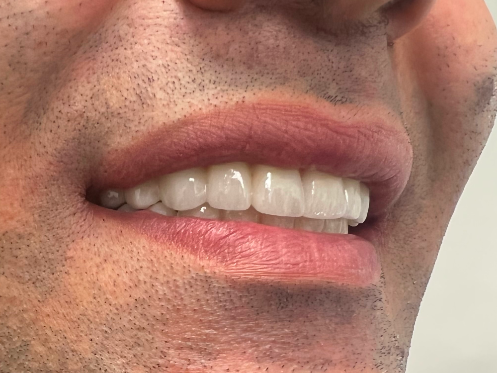 ArtyCad Dental Lab gallery photo 13