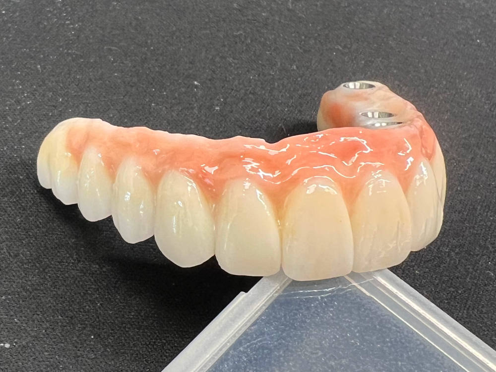 ArtyCad Dental Lab gallery photo 14