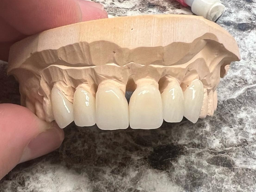 ArtyCad Dental Lab gallery photo 16