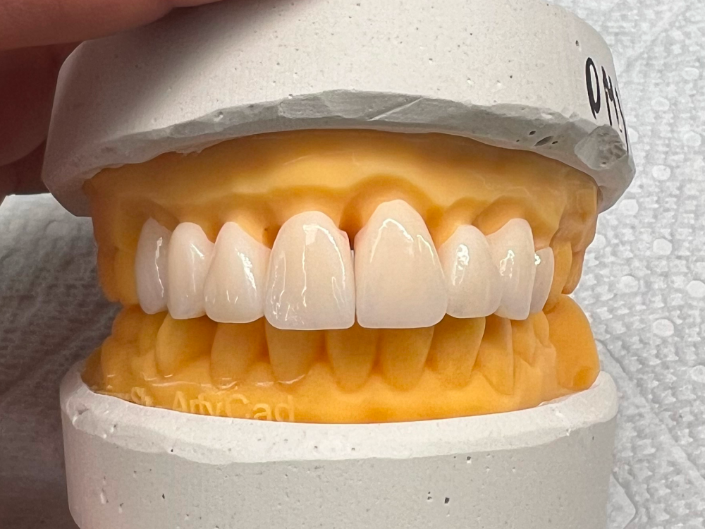 ArtyCad Dental Lab gallery photo 17