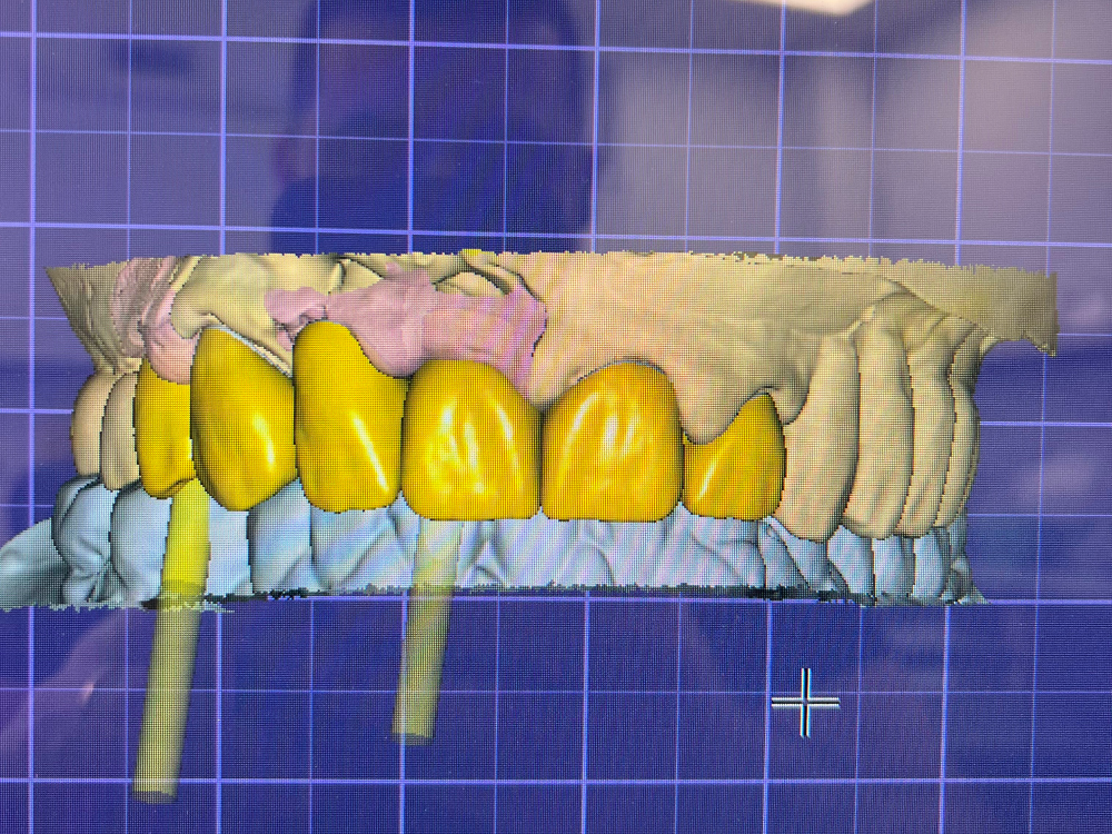 ArtyCad Dental Lab gallery photo 18