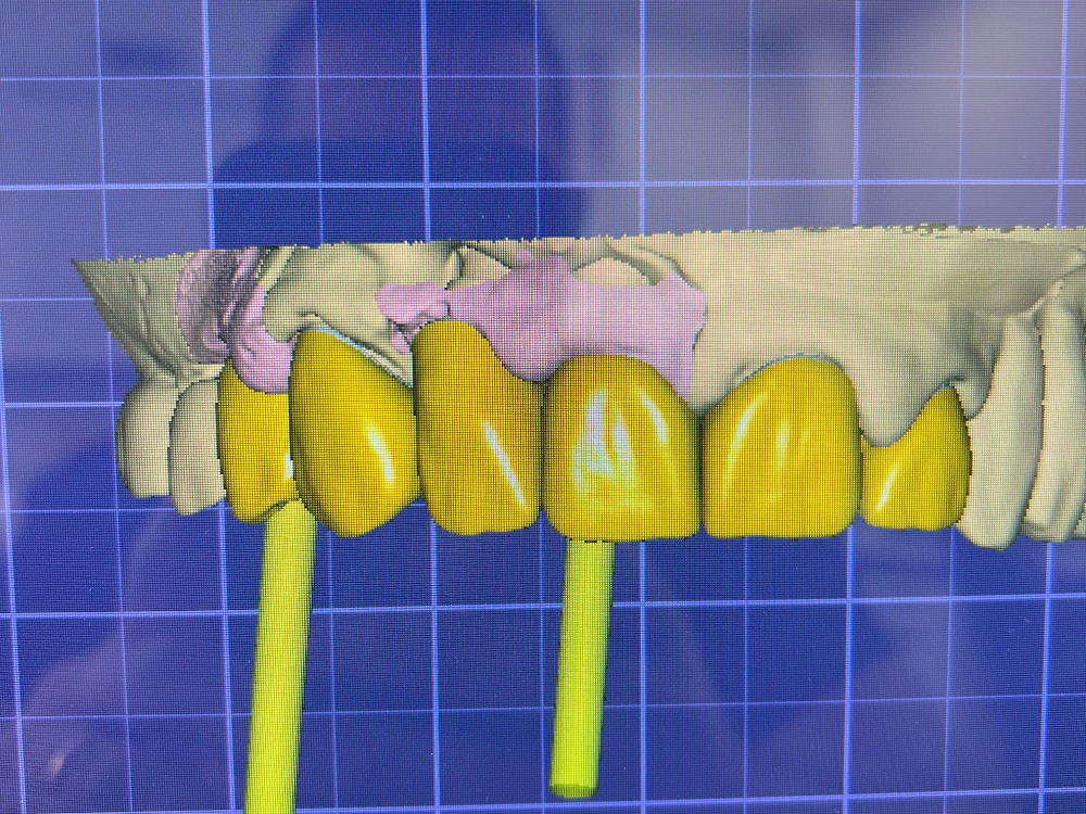 ArtyCad Dental Lab gallery photo 19