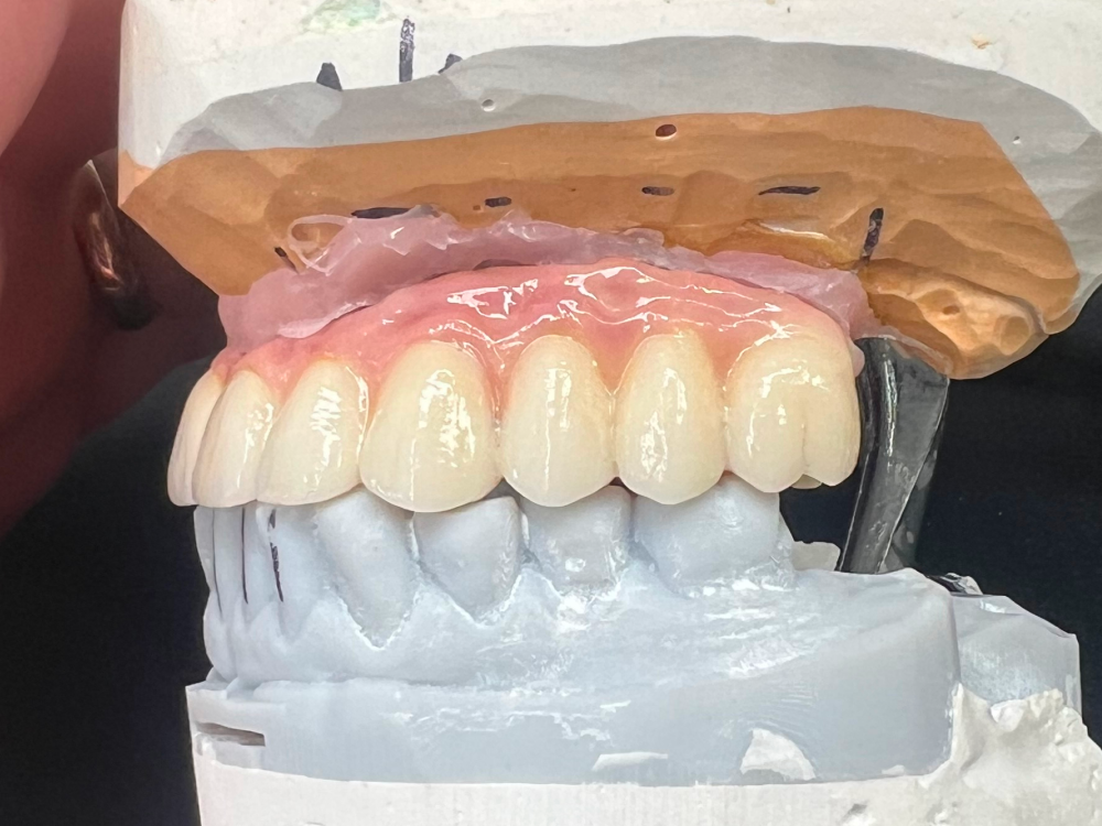 ArtyCad Dental Lab gallery photo 20