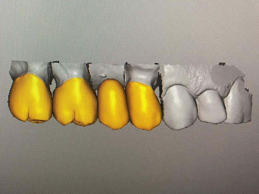 ArtyCad Dental Lab gallery photo 21