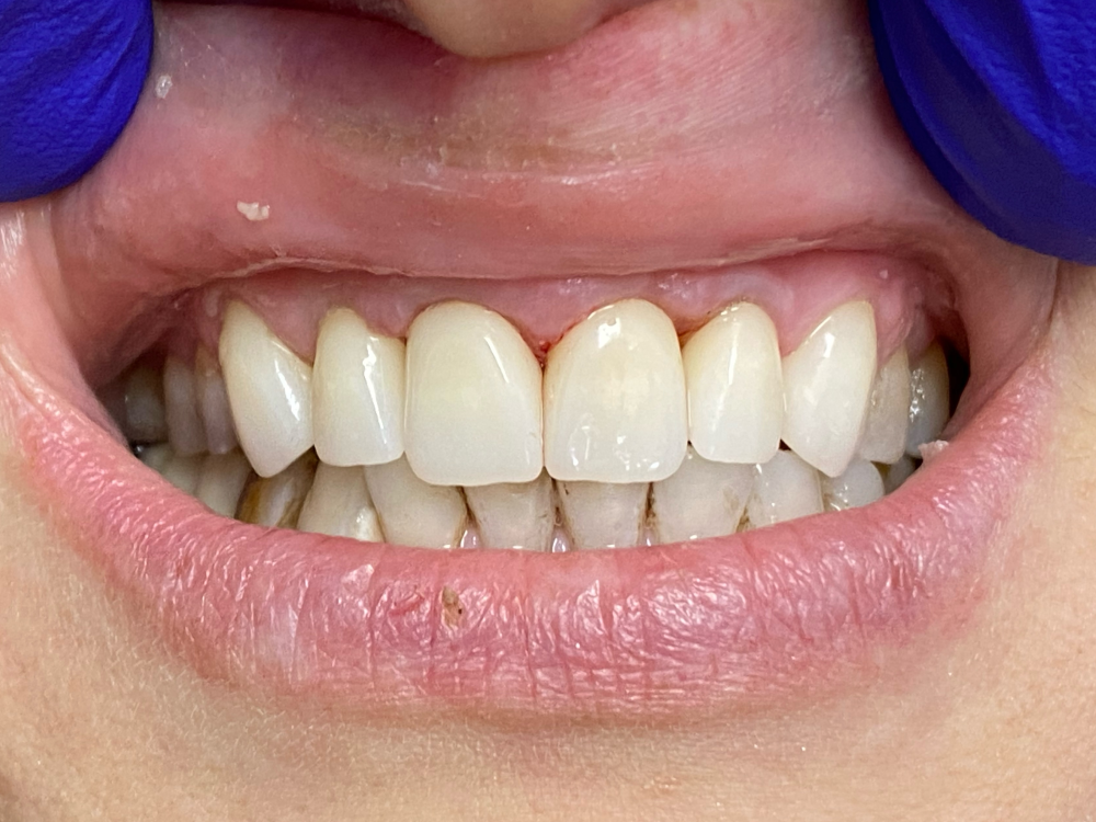 ArtyCad Dental Lab gallery photo 22