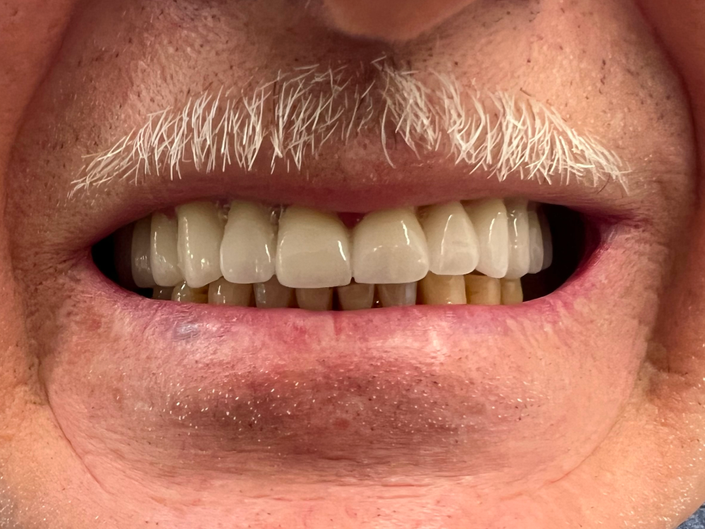 ArtyCad Dental Lab gallery photo 23