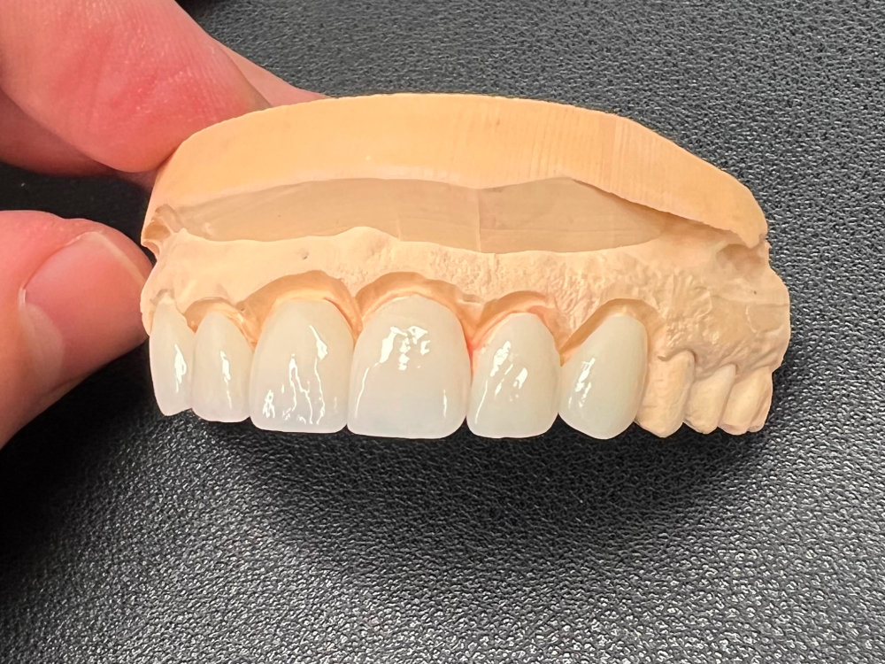 ArtyCad Dental Lab gallery photo 24