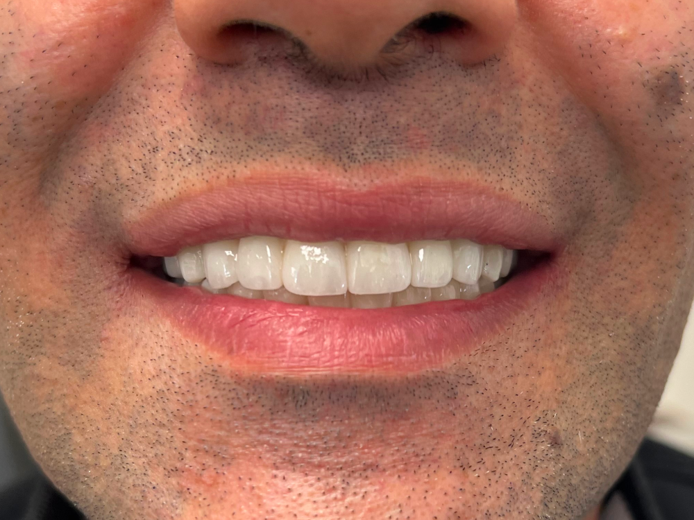 ArtyCad Dental Lab gallery photo 25