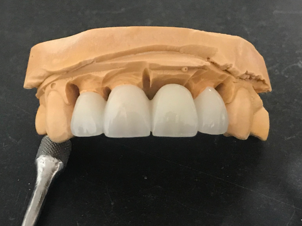 ArtyCad Dental Lab gallery photo 26
