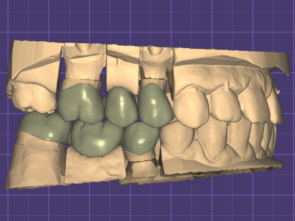 ArtyCad Dental Lab gallery photo 27