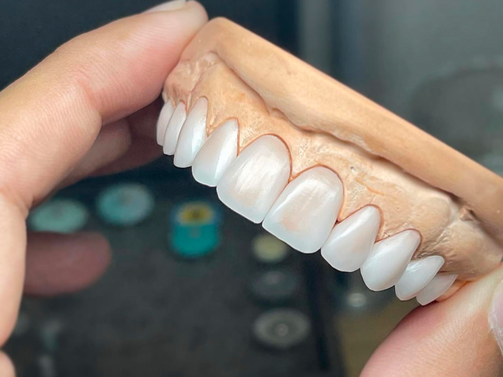 ArtyCad Dental Lab gallery photo 28