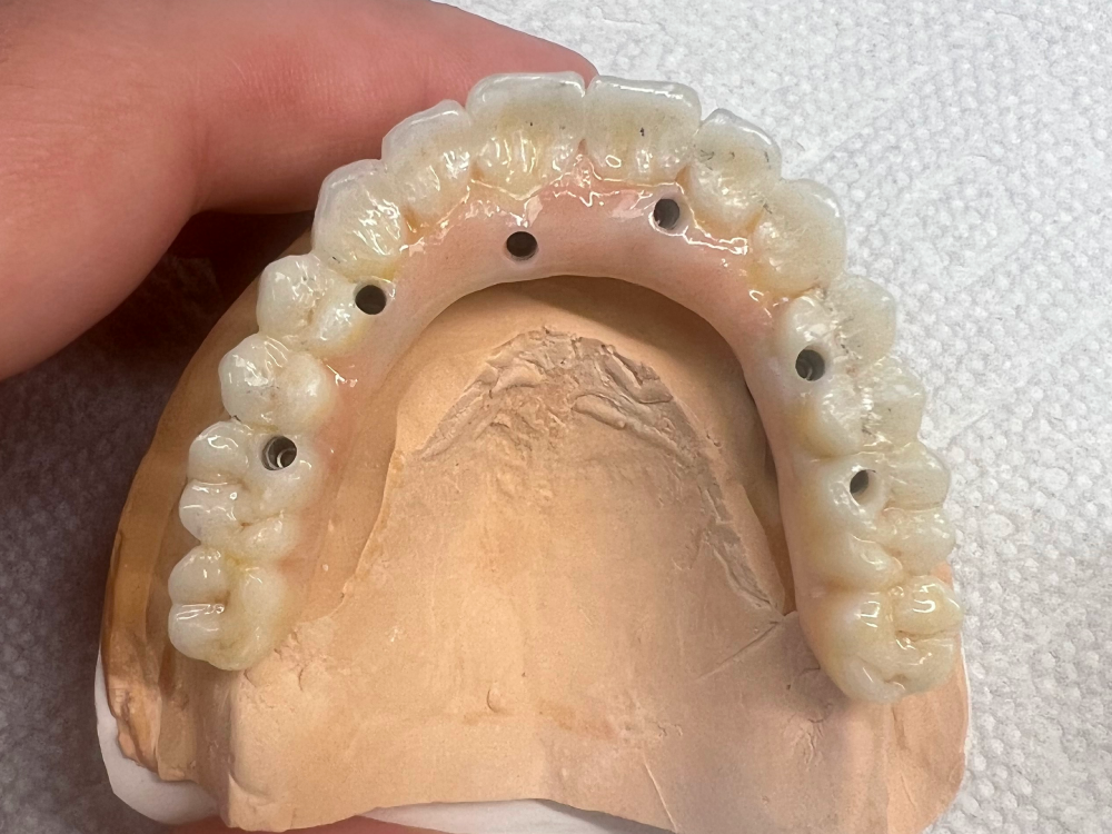 ArtyCad Dental Lab gallery photo 29