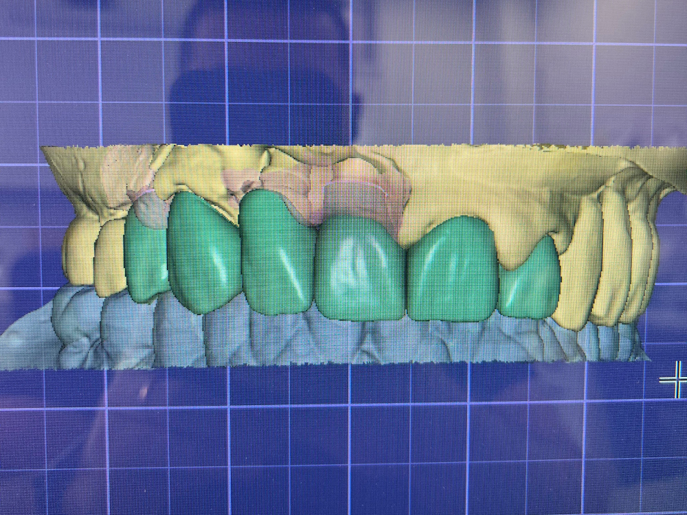 ArtyCad Dental Lab gallery photo 30