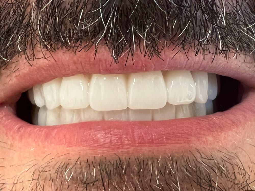 ArtyCad Dental Lab gallery photo 31