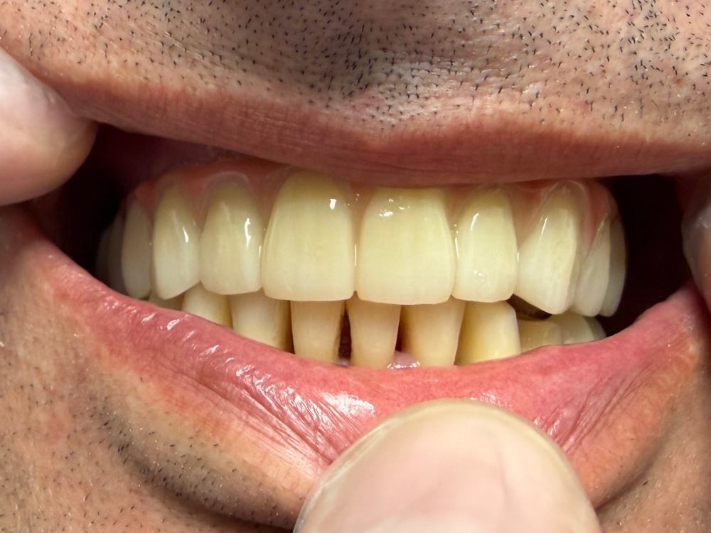 ArtyCad Dental Lab gallery photo 32