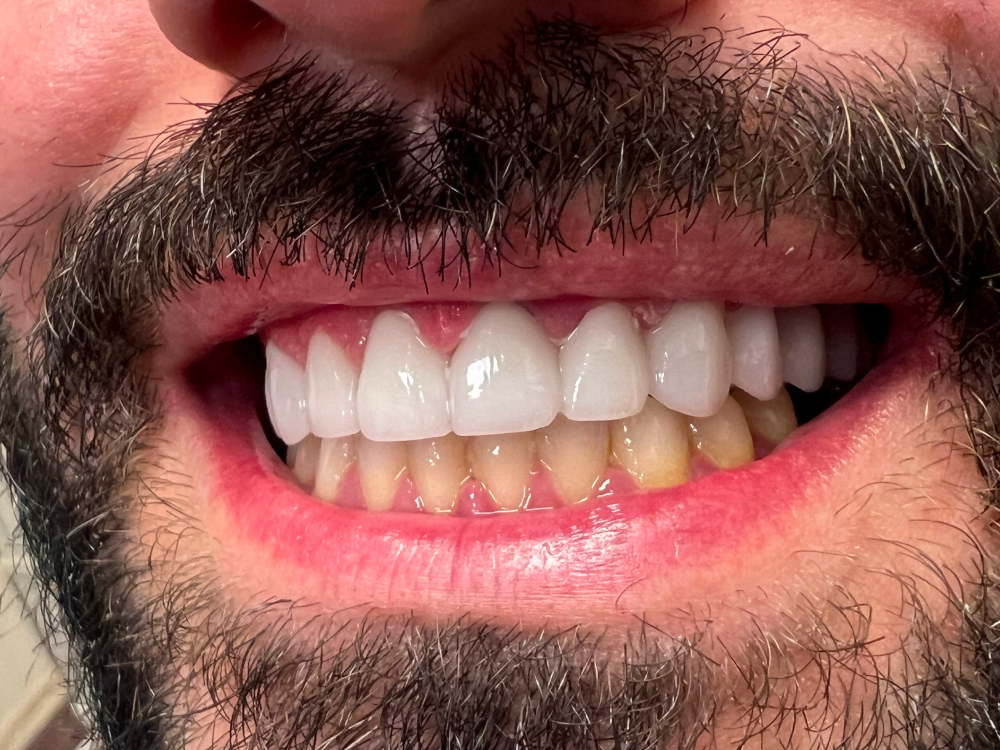 ArtyCad Dental Lab gallery photo 33