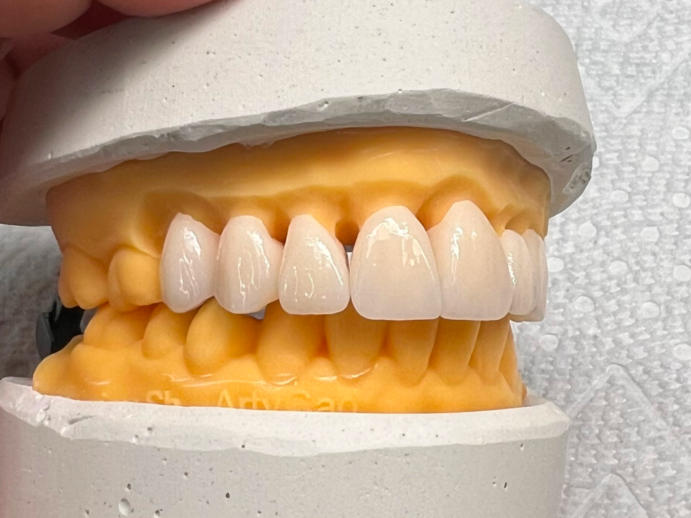 ArtyCad Dental Lab gallery photo 34