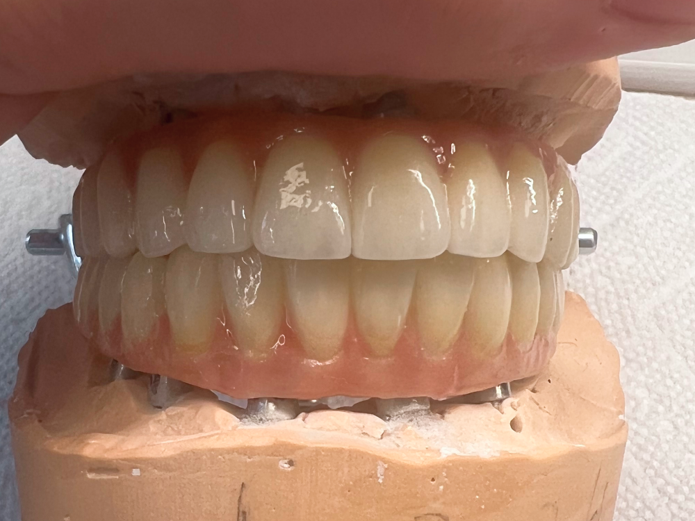 ArtyCad Dental Lab gallery photo 35