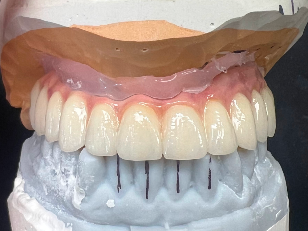 ArtyCad Dental Lab gallery photo 36