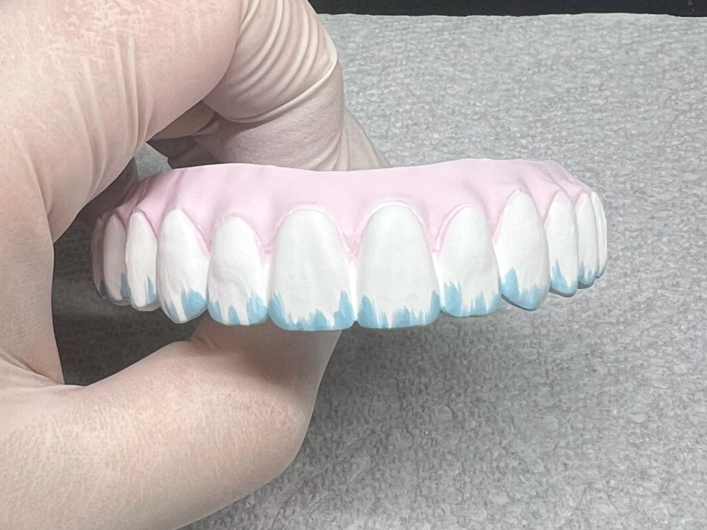 ArtyCad Dental Lab gallery photo 37