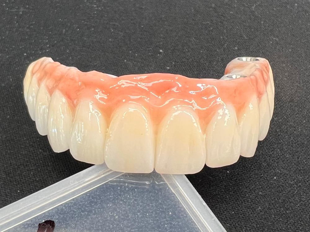 ArtyCad Dental Lab gallery photo 38
