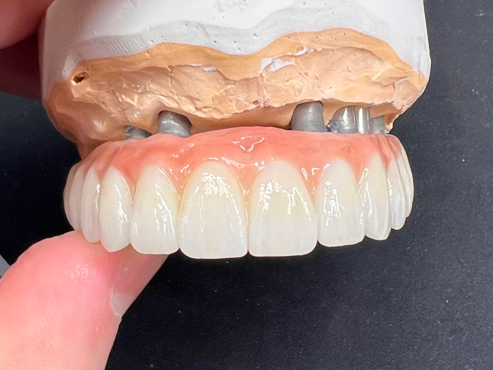 ArtyCad Dental Lab gallery photo 39