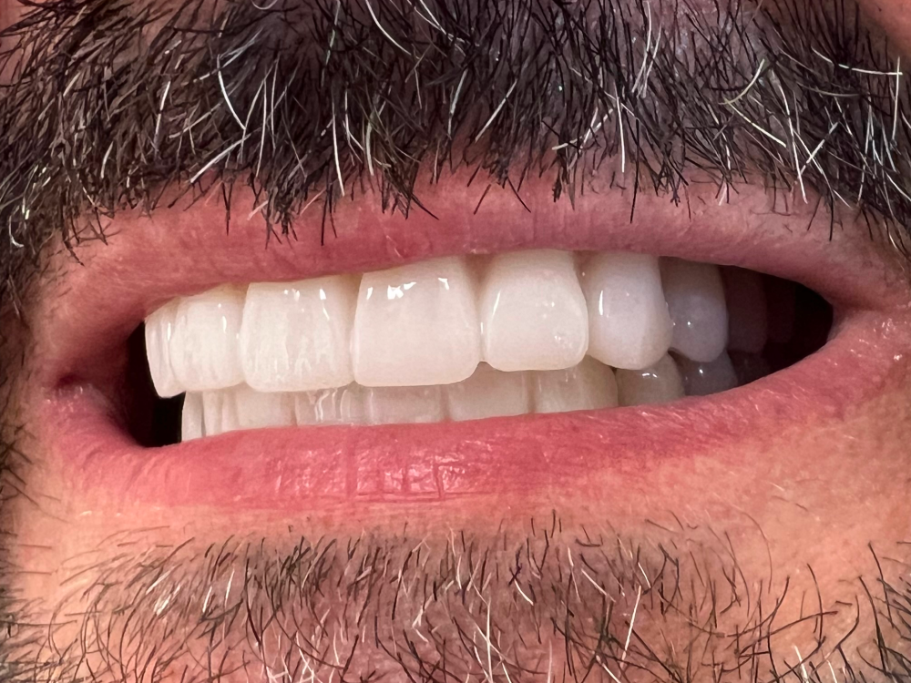 ArtyCad Dental Lab gallery photo 40