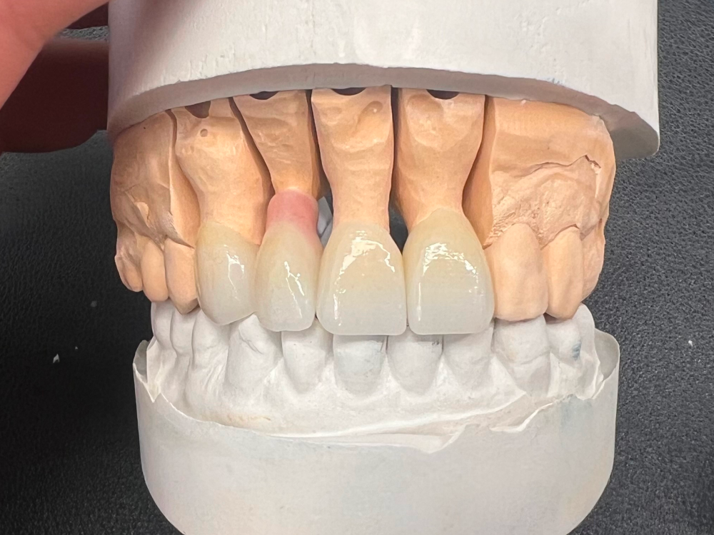 ArtyCad Dental Lab gallery photo 41