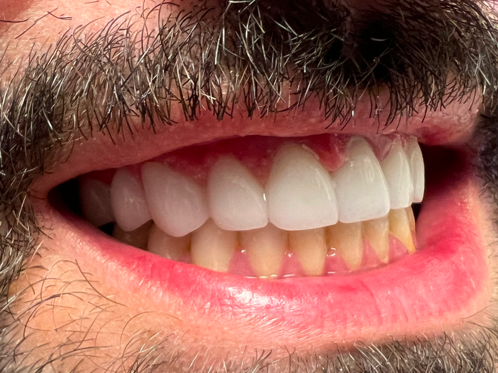 ArtyCad Dental Lab gallery photo 42