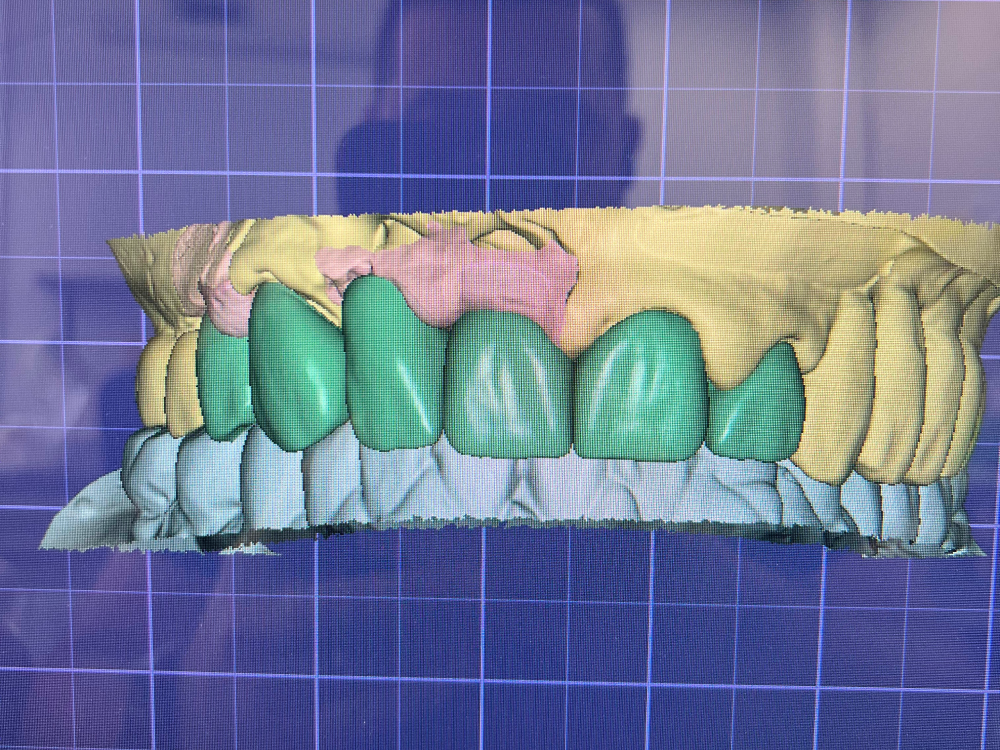 ArtyCad Dental Lab gallery photo 43