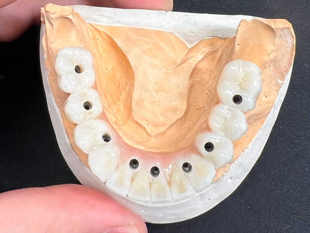 ArtyCad Dental Lab gallery photo 44