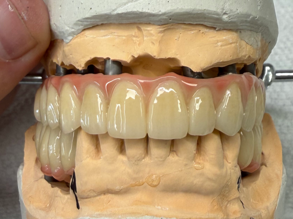 ArtyCad Dental Lab gallery photo 45