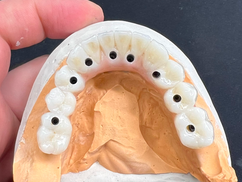 ArtyCad Dental Lab gallery photo 46