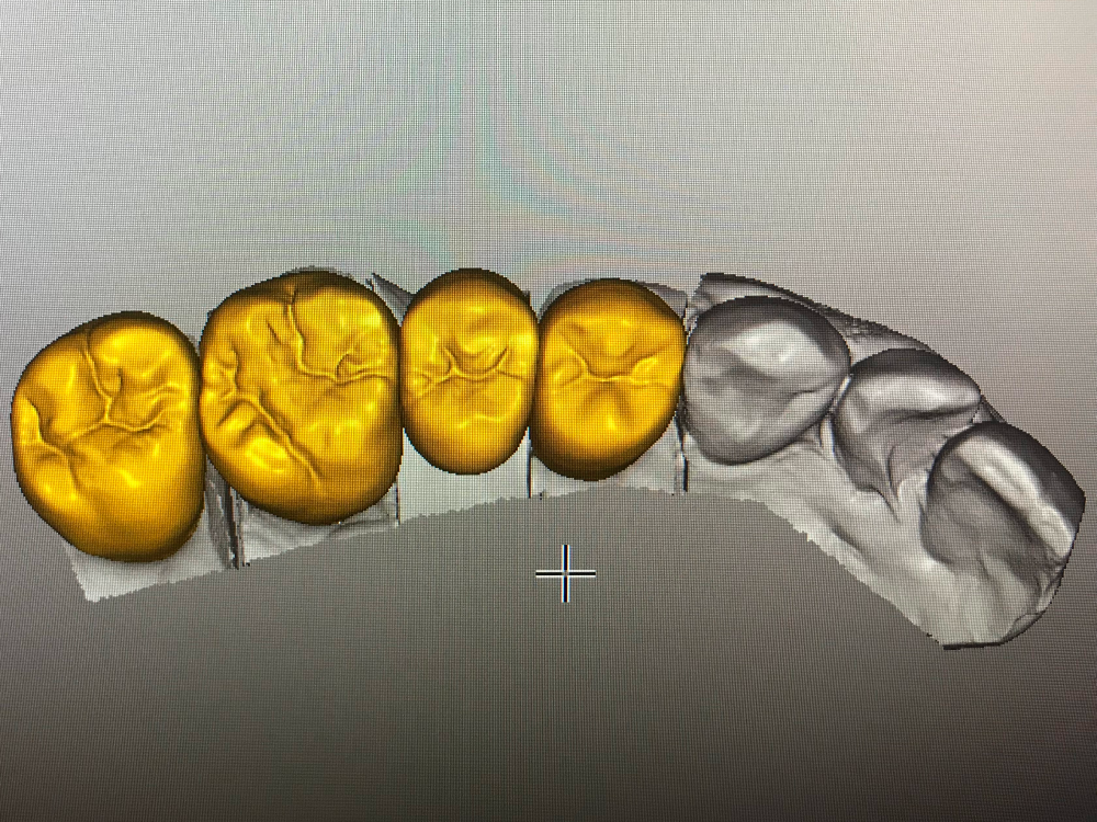 ArtyCad Dental Lab gallery photo 47
