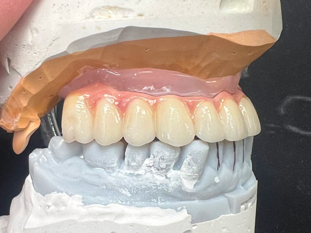 ArtyCad Dental Lab gallery photo 48