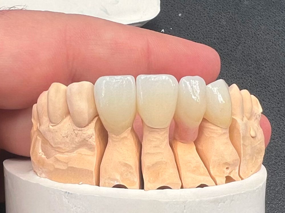 ArtyCad Dental Lab gallery photo 49