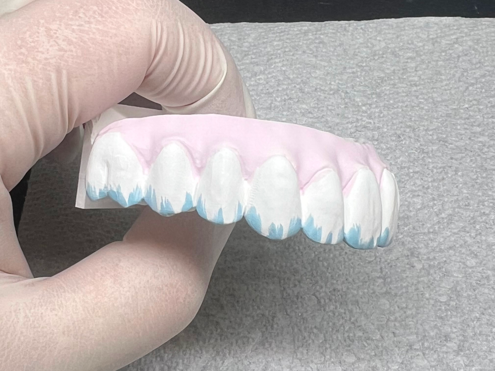 ArtyCad Dental Lab gallery photo 51