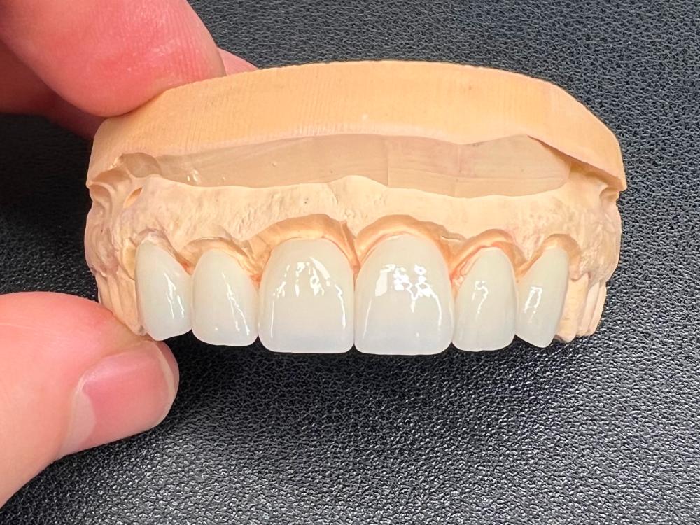 ArtyCad Dental Lab gallery photo 52