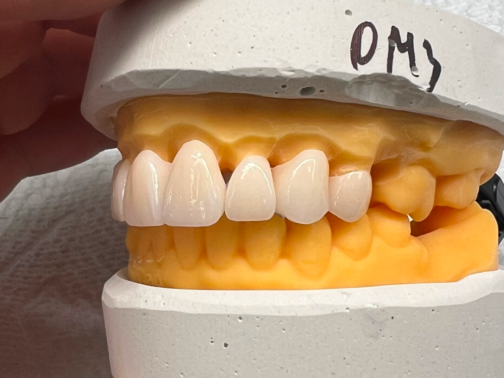 ArtyCad Dental Lab gallery photo 53